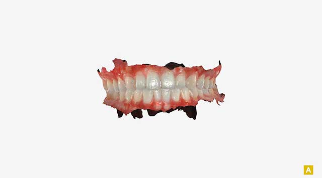 口腔内の状態記録