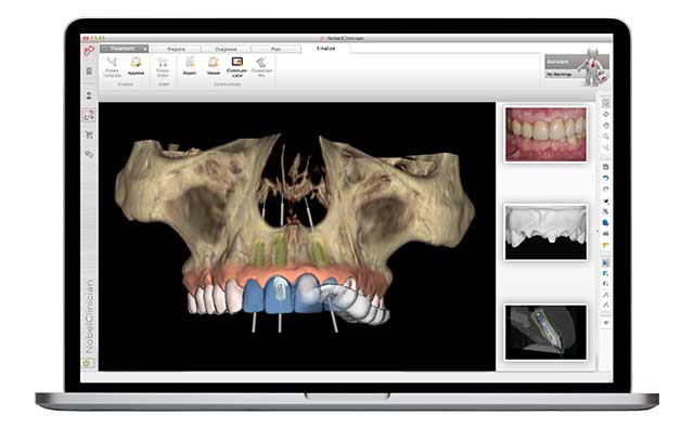 検査結果を元にカウンセリング