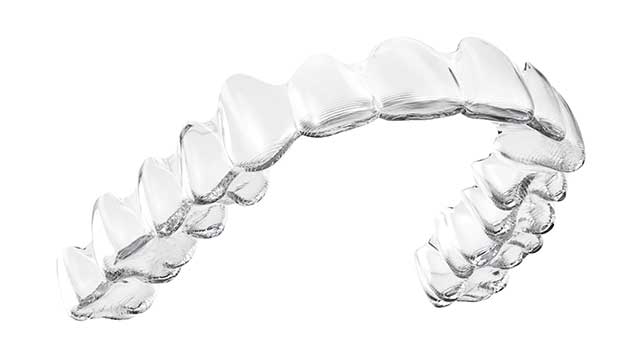 マウスピース矯正